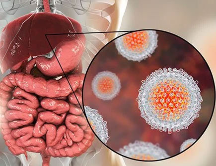 Hepatitis